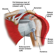NYC Shoulder Injuries Treatment