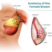 Breast MRI